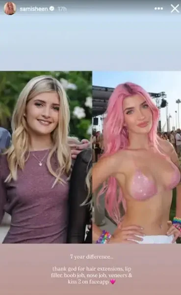 Η 21χρονη Σάμι δημοσίευσε στα Insta stories της φωτογραφίες που δείχνουν την εντυπωσιακή αλλαγή της μέσα σε επτά χρόνια.