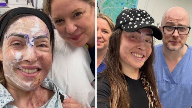 Ιωάννα Παλιοσπύρου: Δημοσίευσε συγκλονιστικές εικόνες από την αποκατάστασή της - Κάνω ένα βήμα πιο κοντά στη ζωή που θέλω