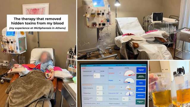 Πλασμαφαίρεση: Η εμπειρία ασθενούς από το ιατρείο όπου φέρεται να έχασε τη ζωή του ο Μαζωνάκης – Οι δύο θεραπείες εντός 48 ωρών και η διαδικασία που “δεν συνίσταται για όλους”